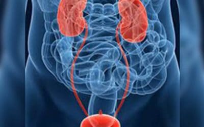 The Silent Killer: Case Of Bladder Cancer