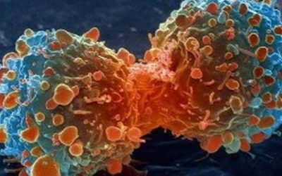 Lifestyle change and Cancer